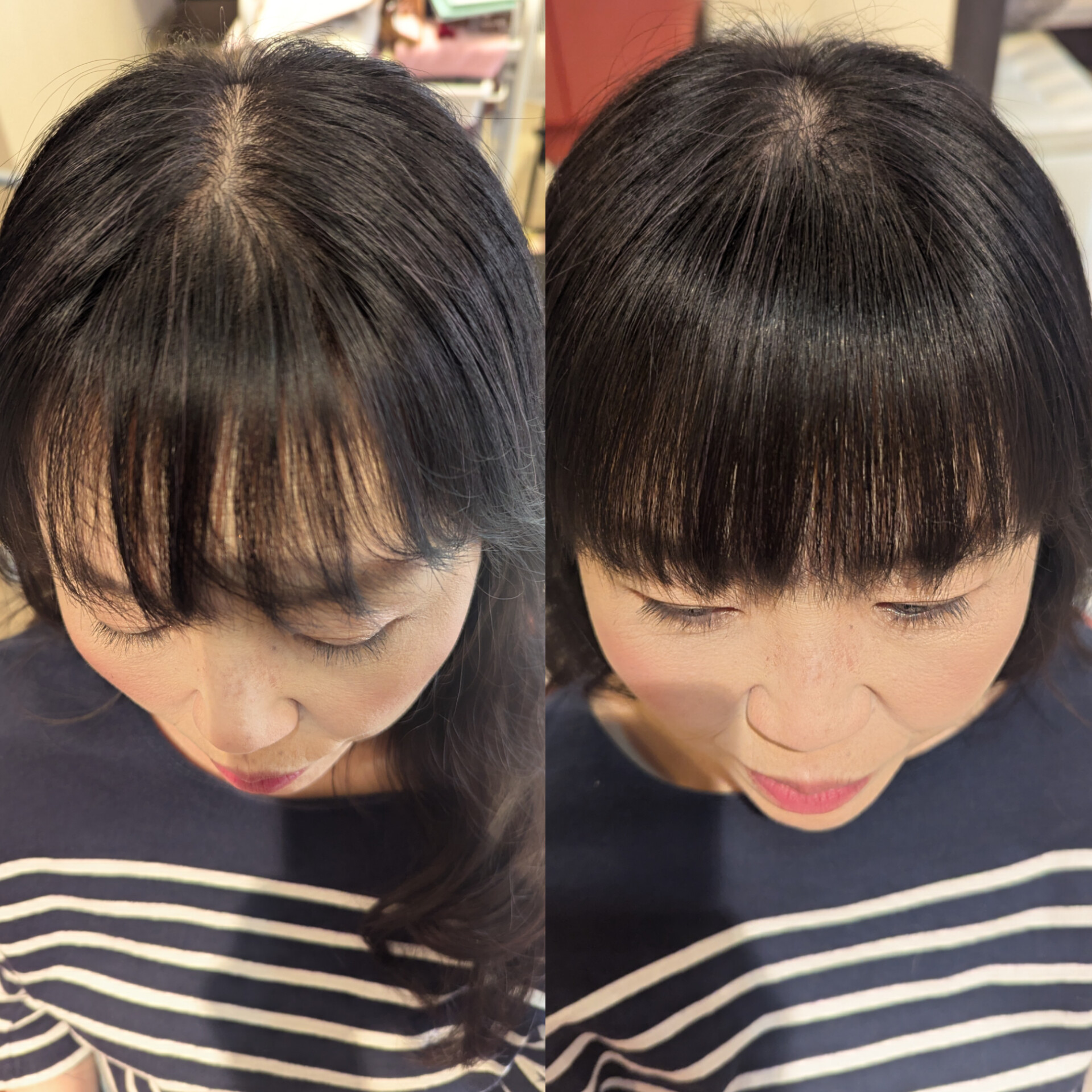 京都RECOLTE Koikeの増毛エクステ施術例｜50代女性の薄毛改善ビフォーアフター